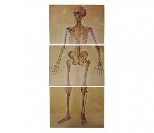 Skeleton - Anatomy Sign in Cleared Metal Signs